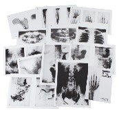 Human X-Ray Print Set – A3 Set
