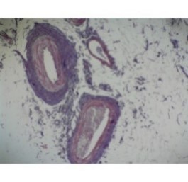 Prepared Microscope Slide – Aorta and Vein T.S.