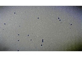 Prepared Microscope Slide – Human Blood