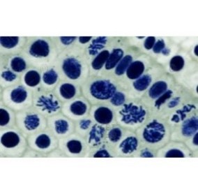 Prepared Microscope Slide Set – Mitosis and Meiosis – Set 1 – Set of 6 Slides Pack of six