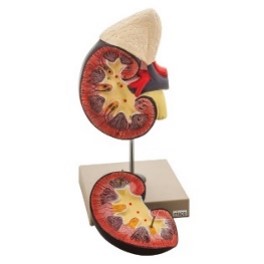 eisco Kidney Model